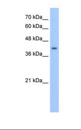 HepG2 cell lysate. Antibody concentration: 2.5 ug/ml. Gel concentration: 12%.