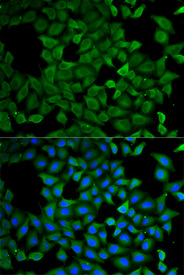 Immunofluorescence analysis of A549 cell using ATL1 antibody. Blue: DAPI for nuclear staining