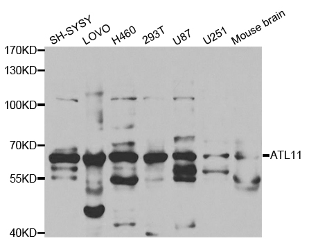 Western blot analysis of extracts of various cell lines, using ATL1 antibody.