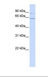 MCF7 cell lysate. Antibody concentration: 1.0 ug/ml. Gel concentration: 12%.