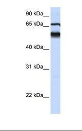 Fetal lung lysate. Antibody concentration: 1.0 ug/ml. Gel concentration: 12%.