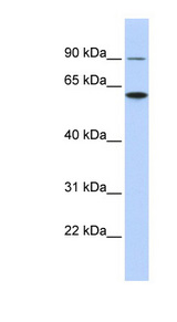 ATL3 antibody LS-C102259 Western blot of HCT15 cell lysate.