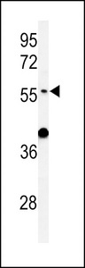 Western blot of ATL3 Antibody in mouse liver tissue lysates (35 ug/lane). ATL3 (arrow) was detected using the purified antibody.