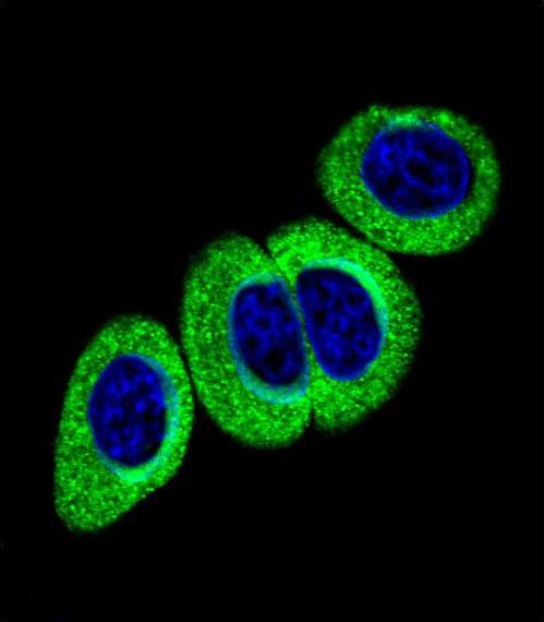 Confocal immunofluorescent of Phospho-ATM-pS1981 Antibody with HeLa cell followed by Alexa Fluor 488-conjugated goat anti-rabbit lgG (green). DAPI was used to stain the cell nuclear (blue).
