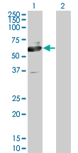 Western blot of PHACS expression in transfected 293T cell line by PHACS monoclonal antibody (M02), clone 1D2.