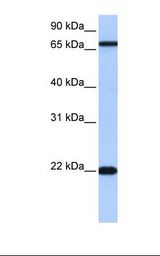 Jurkat cell lysate. Antibody concentration: 0.5 ug/ml. Gel concentration: 12%.