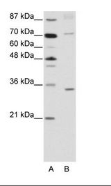 A: Marker, B: Jurkat Cell Lysate