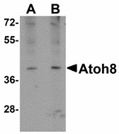 Western blot of ATOH8 in A-20 cell lysate with ATOH8 antibody at (A) 1 and (B) 2 ug/ml. Below: Immunohistochemistry of ATOH8 in mouse brain tissue with ATOH8 antibody at 5 ug/ml.