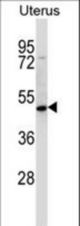 ATOH8 Antibody western blot of human normal Uterus tissue lysates (35 ug/lane). The ATOH8 antibody detected the ATOH8 protein (arrow).