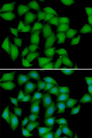Immunofluorescence blot of HeLa cell using ATOX1 antibody. Blue: DAPI for nuclear staining.
