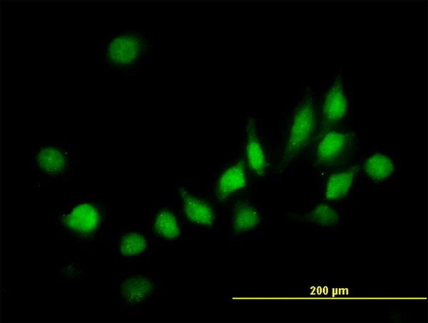 Immunofluorescence of monoclonal antibody to ATOX1 on HeLa cell. [antibody concentration 10 ug/ml]