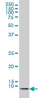 ATOX1 monoclonal antibody (M01), clone 2E6 Western Blot analysis of ATOX1 expression in HeLa NE.