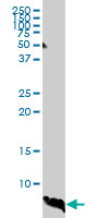ATOX1 monoclonal antibody (M01), clone 2E6. Western Blot analysis of ATOX1 expression in human liver.
