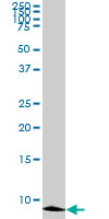 ATOX1 monoclonal antibody (M01), clone 2E6. Western Blot analysis of ATOX1 expression in COLO 320 HSR.
