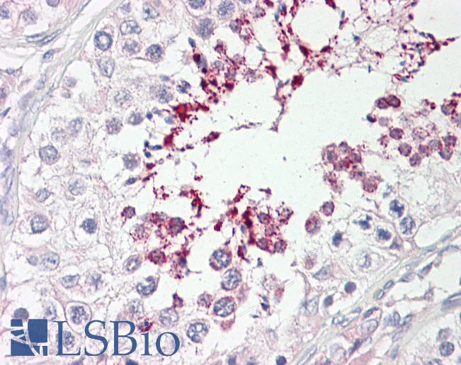 Anti-ATP10D antibody IHC of human testis. Immunohistochemistry of formalin-fixed, paraffin-embedded tissue after heat-induced antigen retrieval. Antibody LS-B8191 dilution 2.5-5 ug/ml.