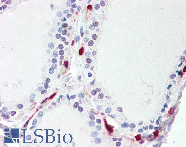 Anti-ATP13A1 antibody IHC staining of human thyroid. Immunohistochemistry of formalin-fixed, paraffin-embedded tissue after heat-induced antigen retrieval.