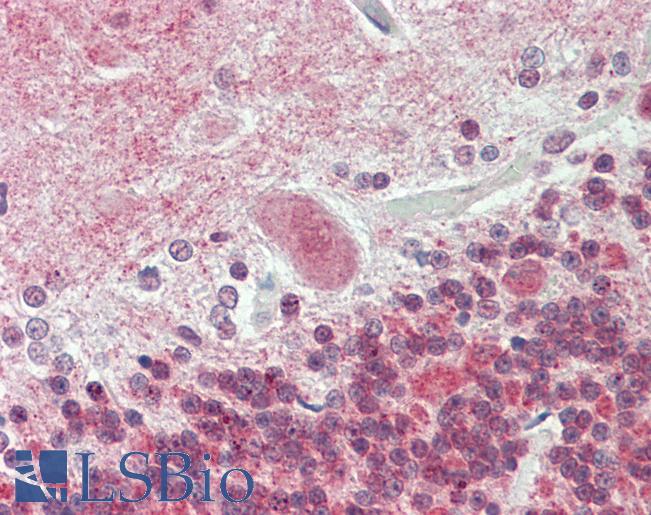 Anti-ATP13A2 antibody IHC staining of human brain, cerebellum. Immunohistochemistry of formalin-fixed, paraffin-embedded tissue after heat-induced antigen retrieval. Antibody LS-B11104 dilution 1:100.