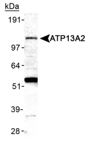 Detection of ATP13A2 in mouse brain membrane lysate.