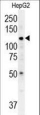 ATP13A3 Antibody western blot of HepG2 cell line lysates (35 ug/lane). The ATP13A3 antibody detected the ATP13A3 protein (arrow).