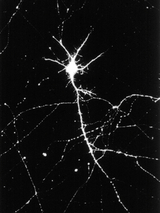 IHC: Hippocampal neurons stained with anti-Na+/K+ATPase -3