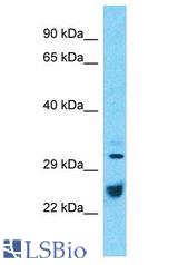 ATP1B1 antibody Western Blot of Thymus Tumor. Antibody dilution: 1 ug/ml.