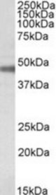 ATP1B1 antibody (0.1 ug/ml) staining of Rat Retina lysate (35 ug protein/ml in RIPA buffer). Primary incubation was 1 hour. Detected by chemiluminescence.