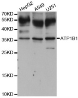 Western blot analysis of extracts of various cell lines, using ATP1B1 antibody.