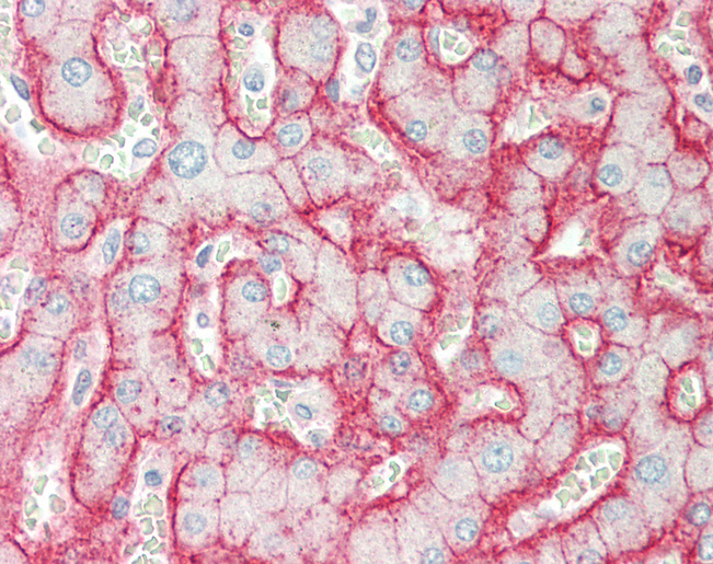 Human Liver: Formalin-Fixed, Paraffin-Embedded (FFPE)