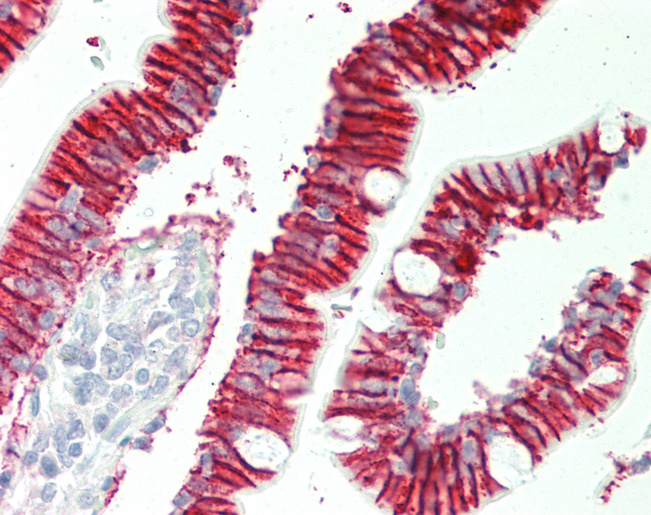 Human Small Intestine: Formalin-Fixed, Paraffin-Embedded (FFPE)