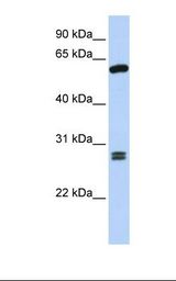 Fetal brain lysate. Antibody concentration: 1.0 ug/ml. Gel concentration: 12%.