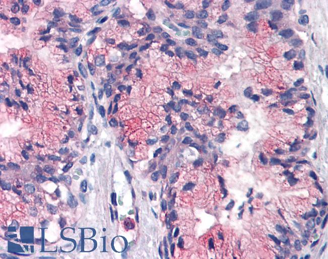 Anti-ATP1B3 antibody LS-A8143 IHC of human prostate. Immunohistochemistry of formalin-fixed, paraffin-embedded tissue after heat-induced antigen retrieval.