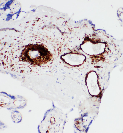 ATP2A1 / SERCA1 antibody. IHC(P): Human Placenta Tissue.