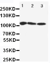 WB of ATP2A1 / SERCA1 antibody. All lanes: Anti-ATP2A1 at 0.5ug/ml. Lane 1: Rat Skeletal Muscle Tissue Lysate at 40ug. Lane 2: PANC Whole Cell Lysate at 40ug. Lane 3: U87 Whole Cell Lysate at 40ug. Predicted bind size: 110KD. Observed bind size: 110KD.