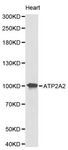 Western blot of ATP2A2 pAb in extracts from mouse heart tissue.