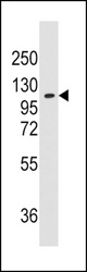 Western blot of anti-AARS antibody in K562 cell line lysates (35 ug/lane). AARS (arrow) was detected using the purified antibody.
