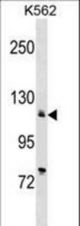 ATP2A2 Antibody western blot of K562 cell line lysates (35 ug/lane). The ATP2A2 antibody detected the ATP2A2 protein (arrow).