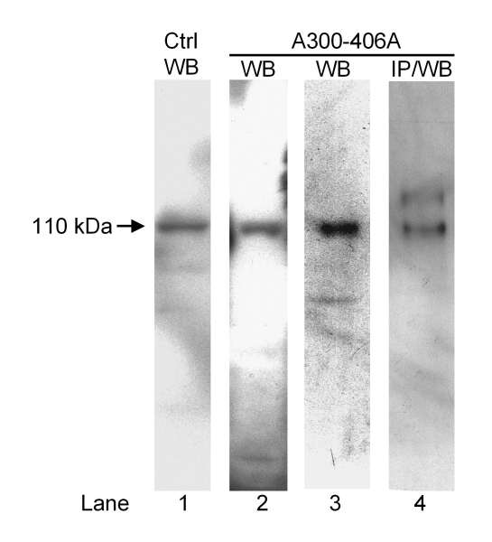 Detection of Pig, Rat and Rabbit SERCA2 by Western Blot and Immunoprecipitation. Sample: Homogenate from pig (lanes 1 and 2) or rabbit (lane 4) aorta or lysate from cultured rat aortic smooth muscle cells (lane 3). Antibody: Affinity purified rabbit anti-SERCA2 used at 1 ug/ml (lanes 2 and 4) or 0.4 ug/ml (lane 3) for WB and 2 ug/mg lysate for IP or control (control) monoclonal anti-SERCA2 (lanes 1 and 4) used at 1 ug/ml for WB. Detection: Chemiluminescence.