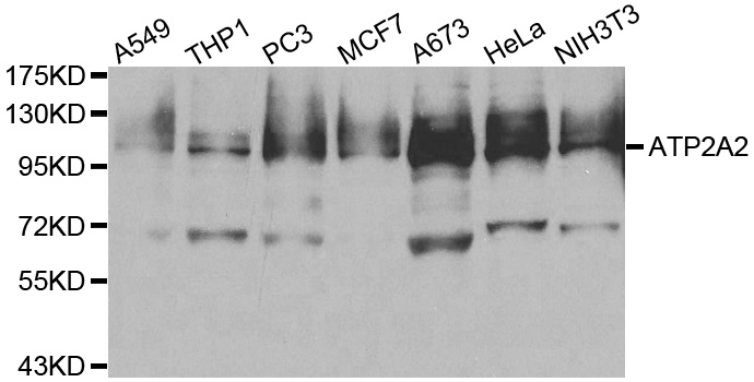 Western blot analysis of extracts of various cell lines, using ATP2A2 antibody.