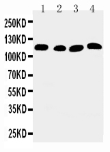 WB of ATP2A2 / SERCA2 antibody. All lanes: Anti-ATP2A2 at 0.5ug/ml. Lane 1: Rat Skeletal Muscle Tissue Lysate at 40ug. Lane 2: Rat Kidney Tissue Lysate at 40ug. Lane 3: PANC Whole Cell Lysate at 40ug. Lane 4: SMMC Whole Cell Lysate at 40ug. Predicted bind size: 115KD. Observed bind size: 115KD.