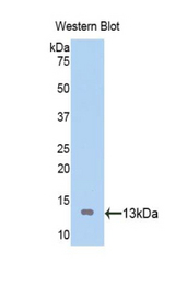 Western blot of recombinant ATP4A.