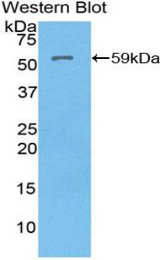 Western blot of recombinant ATP4A.