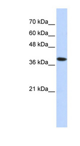 ATP4B antibody LS-C102090 Western blot of Transfected 293T cell lysate.