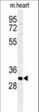 Western blot of ATP4B Antibody in mouse heart tissue lysates (35 ug/lane). ATP4B (arrow) was detected using the purified antibody.