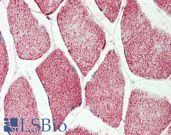 Anti-ATP5A1 / ATP Synthase Alpha antibody IHC staining of human skeletal muscle. Immunohistochemistry of formalin-fixed, paraffin-embedded tissue after heat-induced antigen retrieval.