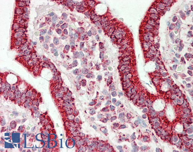 Anti-ATP5A1 / ATP Synthase Alpha antibody IHC staining of human small intestine. Immunohistochemistry of formalin-fixed, paraffin-embedded tissue after heat-induced antigen retrieval. Antibody LS-B11269 concentration 5 ug/ml.