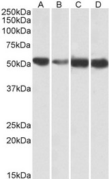 ATP5A1 antibody (0.01 ug/ml) staining of Human (A), fetal Mouse (B), adult Mouse (C) and adult Rat (D) Heart lysates (35 ug protein in RIPA buffer). Primary incubation was 1 hour. Detected by chemiluminescence.