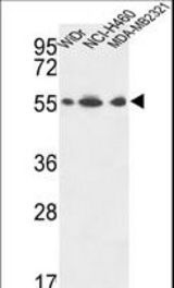 ATP5A1 Antibody western blot of WiDr,NCI-H460,MDA-MB231 cell line lysates (35 ug/lane). The ATP5A1 antibody detected the ATP5A1 protein (arrow).