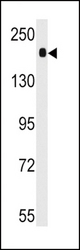 Western blot of anti-ACE Antibody in mouse lung tissue lysates (35 ug/lane). ACE (arrow) was detected using the purified antibody.