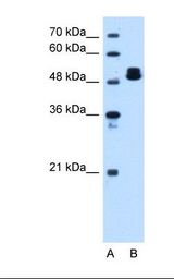 Lane A: Marker. Lane B: HepG2 cell lysate. Antibody concentration: 1.25 ug/ml. Gel concentration: 12%.