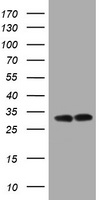 HEK293T cells were transfected with the pCMV6-ENTRY control (Left lane) or pCMV6-ENTRY ATP5C1 (Right lane) cDNA for 48 hrs and lysed. Equivalent amounts of cell lysates (5 ug per lane) were separated by SDS-PAGE and immunoblotted with anti-ATP5C1.